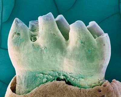 Anti-ageing Drug Rejuvenates The Mouths and Oral Microbiome of Mice